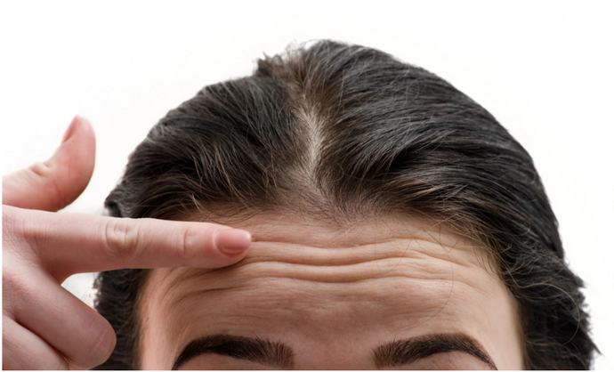Best ways To Reduce Fine Lines on Your Forehead with Vitamin C Serum