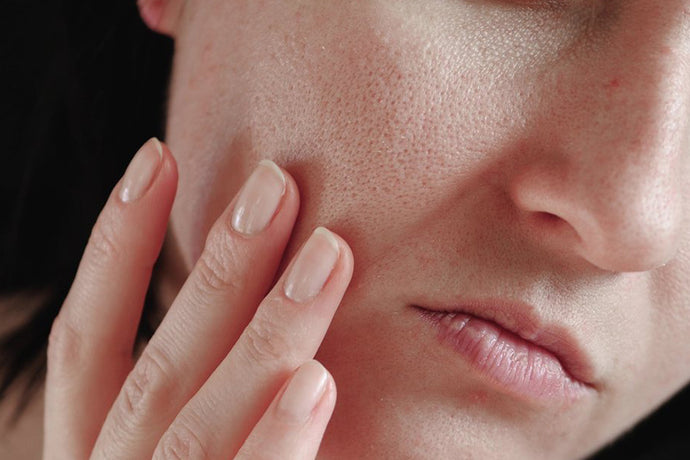 Best Ways to Determine Your Skin Type