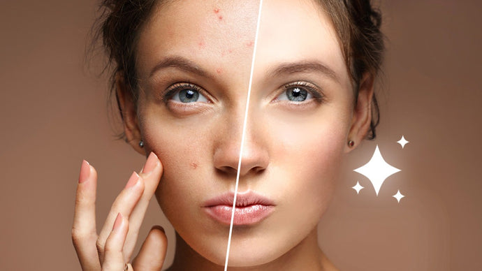Why Vitamin C Serum is a Necessary for Your Skincare